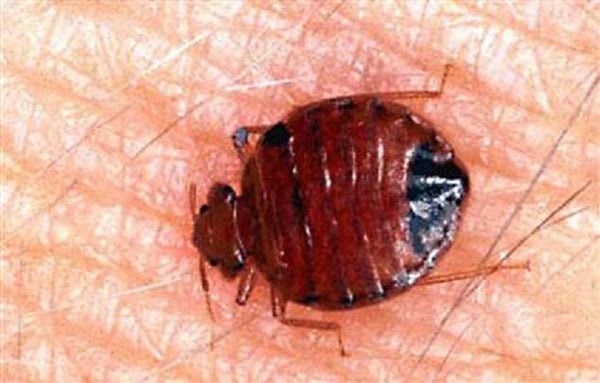 A bed bug on a person's skin.